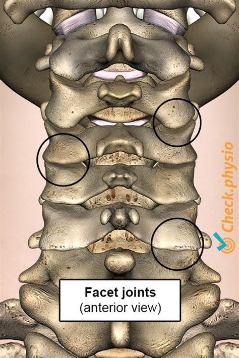 Cervical facet syndrome | Physio Check