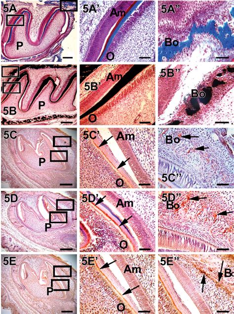 Temporal And Spatial Localization Of The Dentin Matrix Proteins During