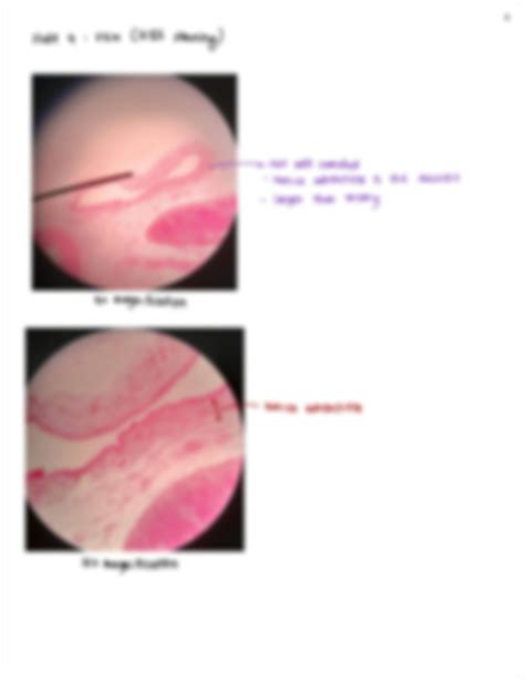 SOLUTION: Anatomy Histology of Blood Vessels & Heart - Studypool