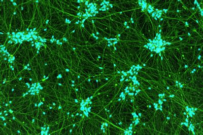 Quick Neuron GABAergic MRNA Kit