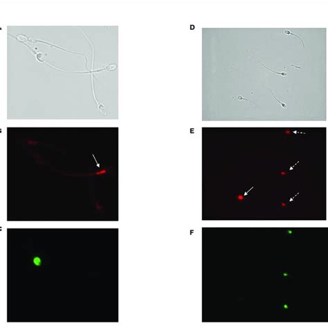 A C Images Of Fluorescence Microscopy Of Bright Field A Cellrox