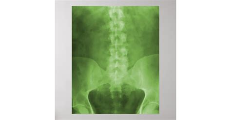 Green Digital X Ray Art Print Zazzle