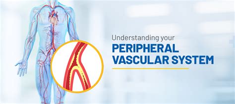 Peripheral Vascular System | Add More to Life - Meril