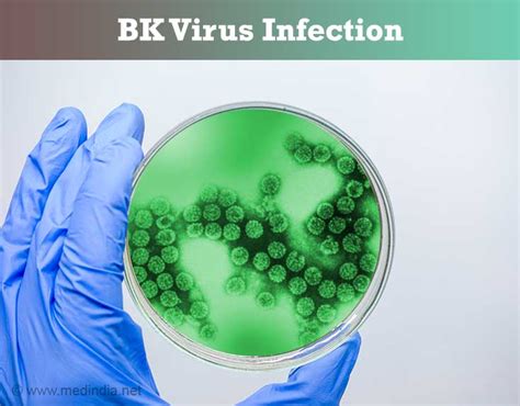 BK Virus Infection - Risk Factors, Symptoms, Signs, Diagnosis ...