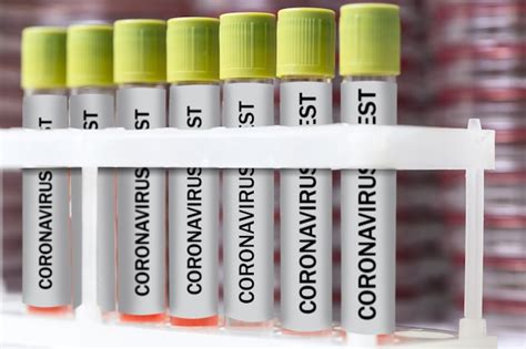 Investigación de laboratorio de coronavirus envases o tubos con tapa