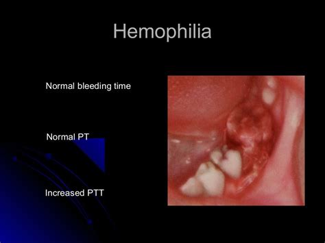 Oral Diagnosis And Systemic Diseases