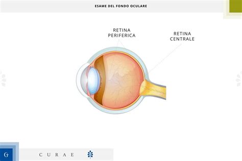 Fondo Oculare Cosa Si Vede Quando Si Fa Preparazione E Durata