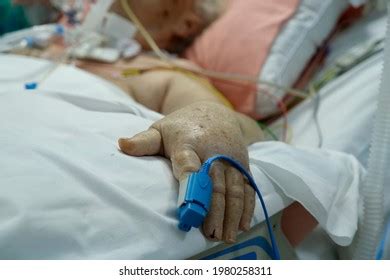 Pulse Oximetry Covid-19 Patients Finger Intensive Stock Photo ...