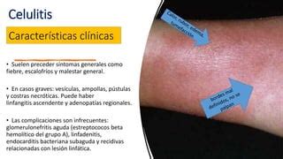 DIAPOSITIVAS SOBRE CELULITIS APOYO MEDICO Pptx