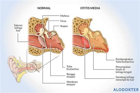 Fungsi Saluran Eustachius Newstempo