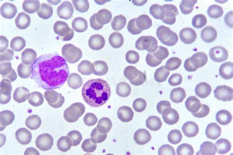 Monocyte And Neutrophil Cell In Blood Smear Stock Photo Image Of