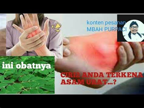 Ciri Ciri Anda Terkena Asam Urat Treat Gout Without Side Effects