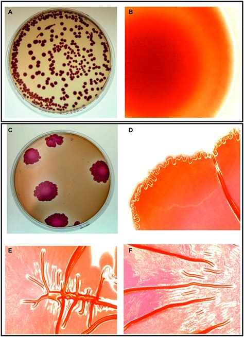 Frontiers Rugose Morphotype In Salmonella Typhimurium And Salmonella