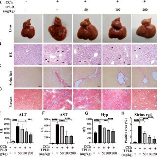 Tplr Ameliorated Liver Injury And Reduced Hepatic Fibrosis In Ccl