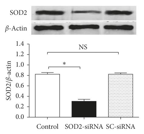 Sod Sirna Reversed Curcumin Induced Cytoprotection And Sod