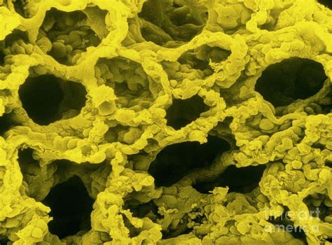 False Col Sem Of Lung By Science Photo Library