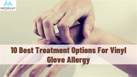 10 Best Treatment Options For Vinyl Glove Allergy - Medrux