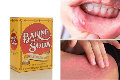 12 Fantastic Uses For Baking Soda Very Few Know About Healthy Points