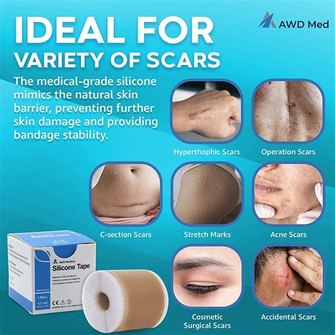 Awd Medical Silicone Scar Sheets Reusable Scar Tape For Keloids C