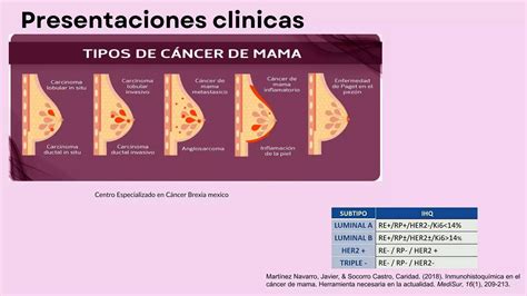 Patolog As Malignas Mamarias Pptx