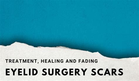 Eyelid Surgery Scar Treatment Healing And Fading Dr Michael Kernohan