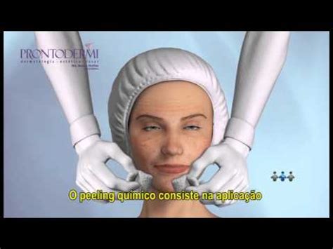 Peelings Qu Mico E De Cristal Prontodermi Youtube