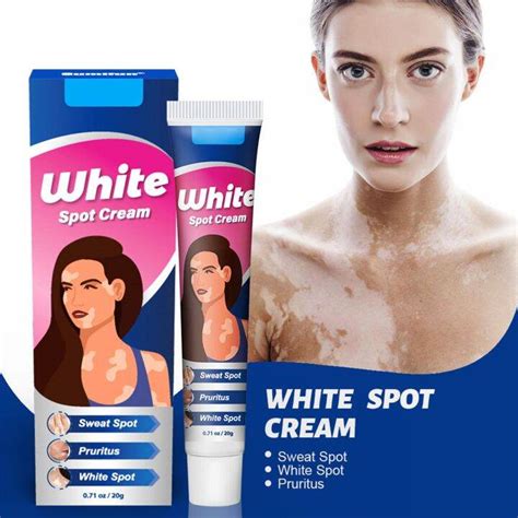 Vitiligo Ointment Herbal Extract Remove Ringworm White Spot Removal