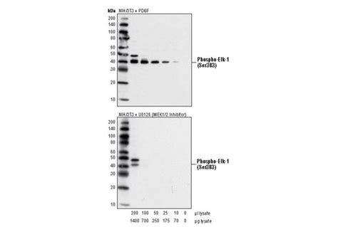 p44/42 MAP Kinase Assay Kit (Nonradioactive) | Cell Signaling Technology 