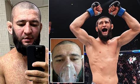 Ufc Superstar Khamzat Chimaev Reveals Alarming Hospital Pictures