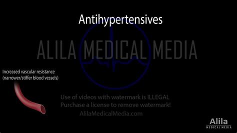 Alila Medical Media Heart And Blood Circulation Videos