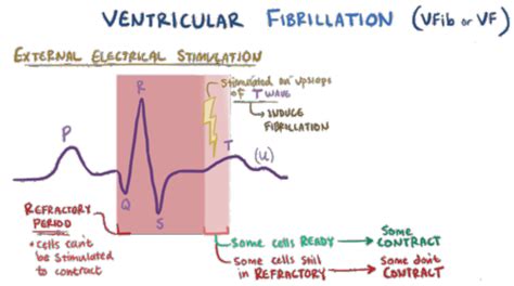 Cardiac Flashcards Quizlet