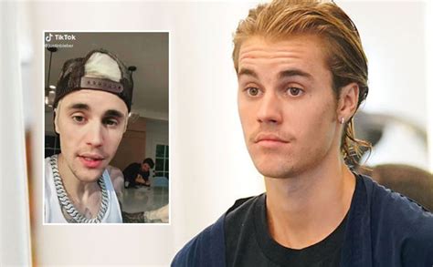 Justin Bieber On Tiktok Shares Then And Now Pics For His First Post