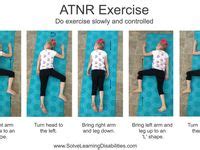 29 ATNR exercises ideas | primitive reflexes, vision therapy, pediatric physical therapy