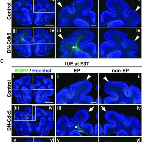 CRISPR Cas9 Mediated Knockout Of The Cdk5 Gene In The Ferret Cerebral