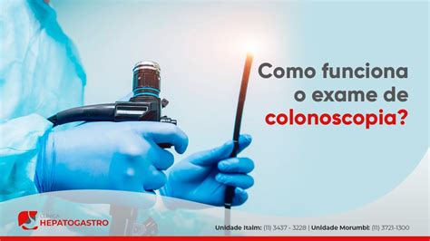 Como funciona o exame de colonoscopia Clínica Hepatogastro YouTube