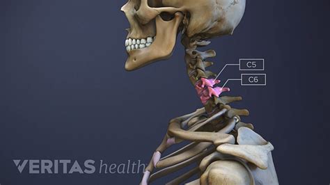 All About The C5 C6 Spinal Motion Segment