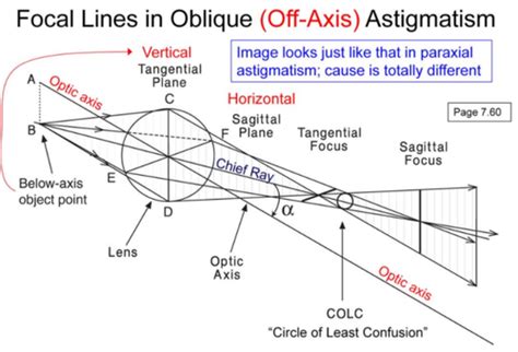 4 Chapter 15 More Monochromatic Aberrations Flashcards Quizlet