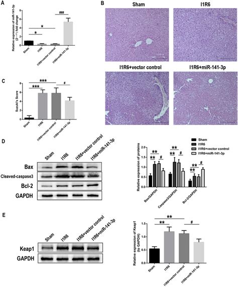 Mir P Inhibits Iri Triggered Hepatic Dysfunction And Apoptosis In