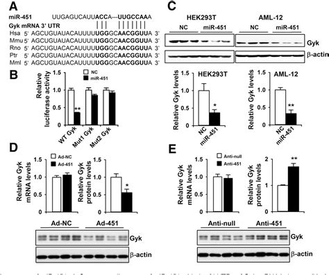 Figure 1 From MicroRNA 451 Negatively Regulates Hepatic Glucose