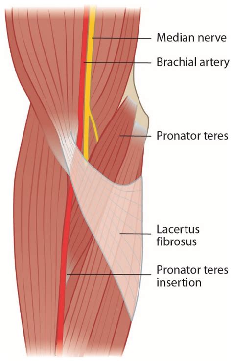 Jcm Free Full Text Proximal Median Nerve Compression In The