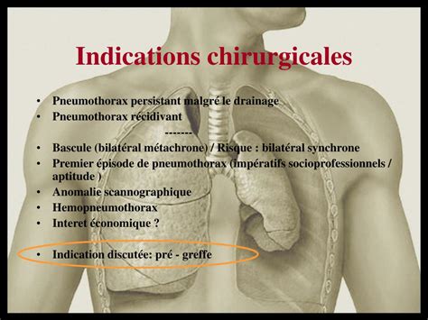 Ppt Traitement Chirurgical Du Pneumothorax Spontan Powerpoint