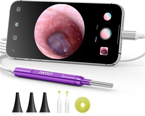 Amazon Anykit Usb C Digital Otoscope For Type C Phone Tablet