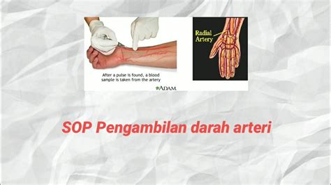 Sop Pengambilan Darah Arteri Analisa Gas Darah Youtube