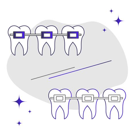 Metal Braces Vs Ceramic Braces How They Actually Compare