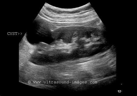 A Gallery of High-Resolution, Ultrasound, Color Doppler & 3D Images ...