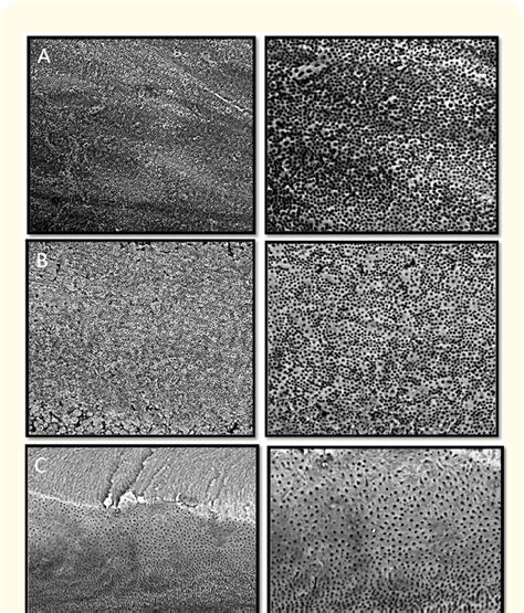 SEM micrographs showing smear layer removal in samples of Group I ...