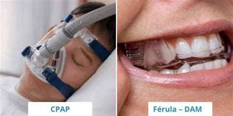 Apnea CPAP Clinica Aguilar Dental Salut En Barcelona