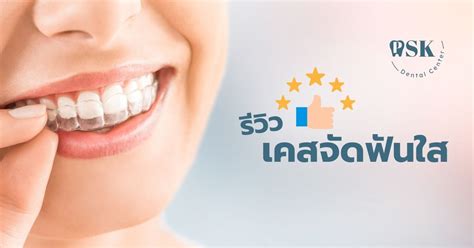 รีวิว จัดฟันใส Psk Dental Center