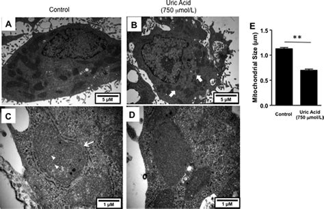 Uric Acid Induces Mitochondrial Morphology Changes In Hepg Cells