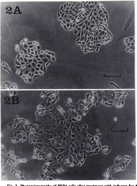 Figure 1 From Effect Of Sodium Butyrate And Other Differentiation